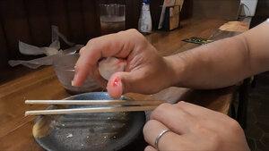 噛まれたらしい？