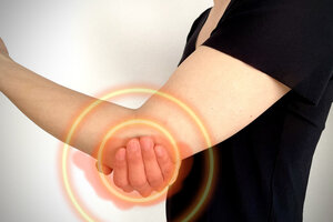 滑液包炎 になってしまった